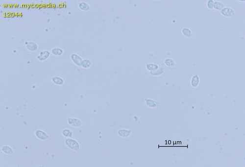 Leptosporomyces mutabilis - Sporen - 