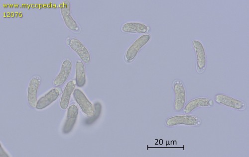 Vuilleminia comedens - Sporen - Melzers  - 