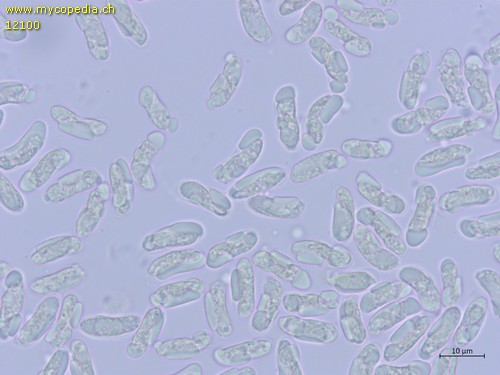 Auricularia mesenterica - Sporen - Melzers  - 