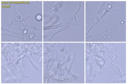 Radulomyces molaris - Hyphenenden der Kortikalschicht - 