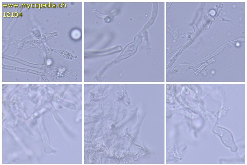 Radulomyces molaris - Hyphenenden der Kortikalschicht - 