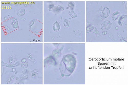 Radulomyces molaris - Sporen - 