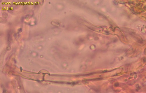 Hypochniciellum ovoideum - Hyphen mit Schnallen - Kongorot  - 