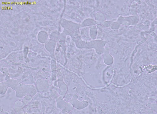 Ceraceomyces serpens - Hyphen - 