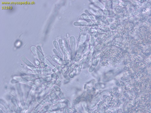 Ceraceomyces serpens - Basidien - 