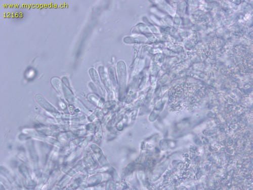 Crystallicutis serpens - Basidien - 