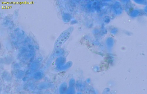 Sistotrema coroniferum - Gloeozystiden - Baumwollblau  - 