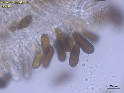 Diplodia sapinea - Anamorphe Sporen - 