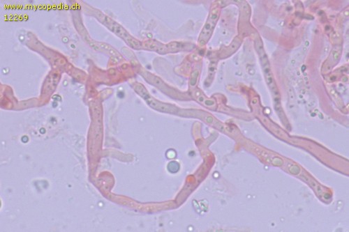 Fibroporia gossypium - Hyphen - Kongorot  - 