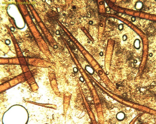 Scutellinia trechispora - Haare - 