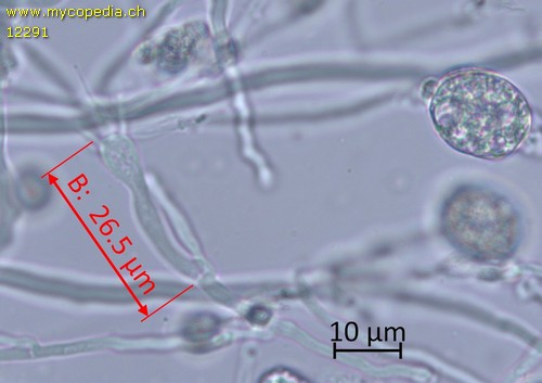 Adustoporia sinuosa - Basidien - 