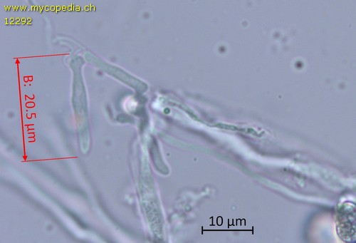 Adustoporia sinuosa - Zystidiole/n - 