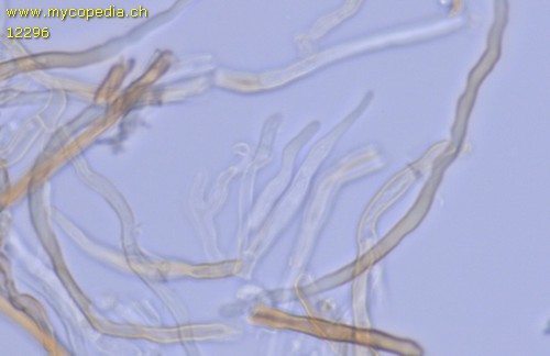 Fomitiporia hippophaeicola - Zystidiole/n - 