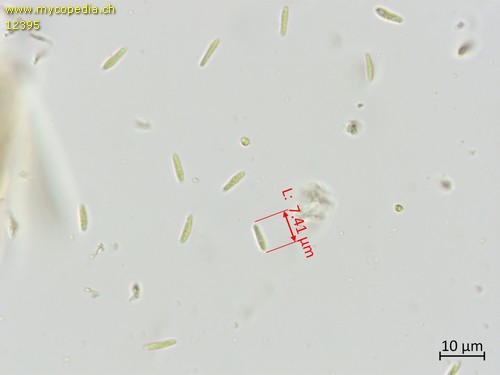 Cyathicula cyathoidea - Sporen - 