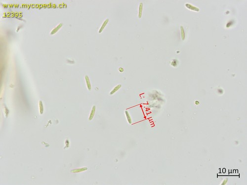 Cyathicula cyathoidea - Sporen - 