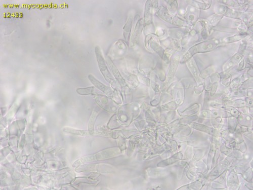 Hypocrea citrina - Konidiosporen - 