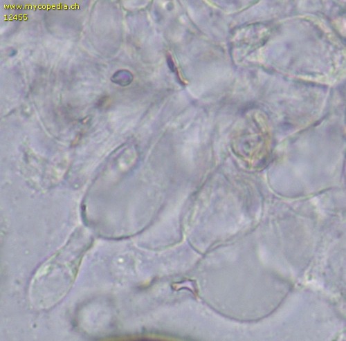 Leucoagaricus nympharum - Cheilozystiden - 