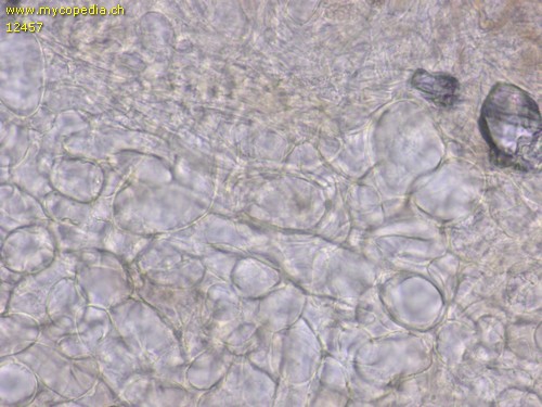 Leucoagaricus nympharum - HDS - 