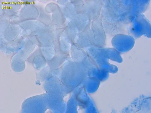 Peziza echinospora - Excipulum - Baumwollblau  - 