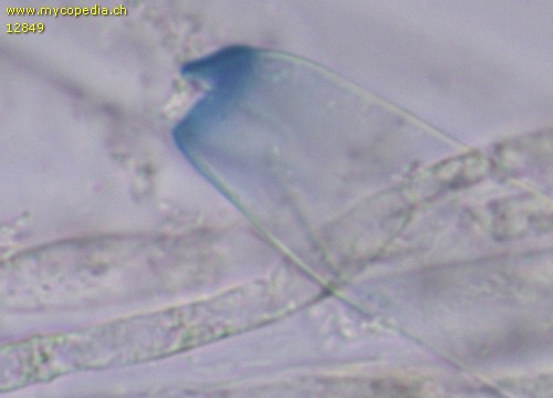 Peziza echinospora - Ascusspitze mit geöffnetem Operculum - Melzers  - 