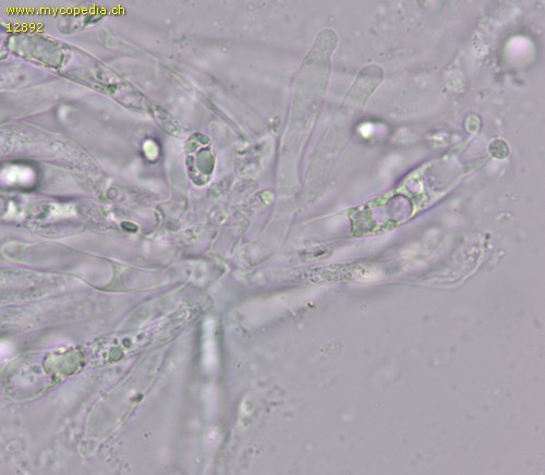 Hygrocybe miniata var. miniata - Cheilozystiden - 