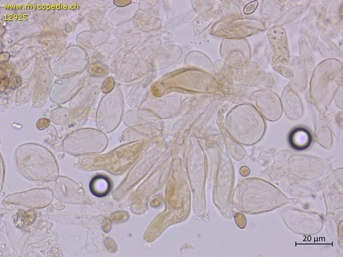 Inocybe leiocephala - Cheilozystiden und Marginalzellen - KOH  - 