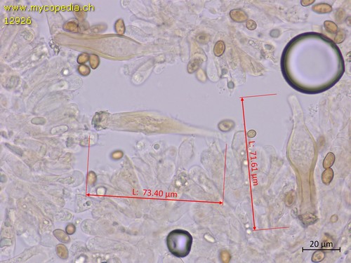 Inocybe leiocephala - Zystiden - KOH  - 