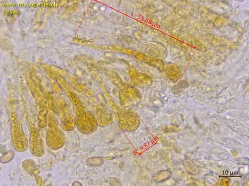 Pholiota tuberculosa - Chrysozystiden - 