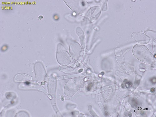 Agaricus macrocarpus - Cheilozystiden - 