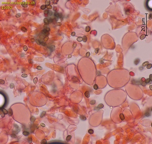 Agaricus porphyrizon - Marginalzellen - 