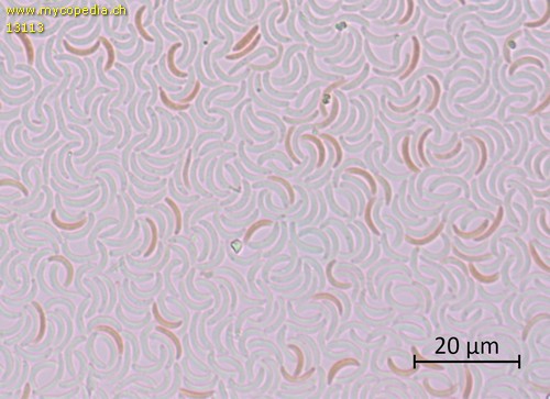 Cytospora leucosperma - Konidiosporen - 