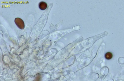 Psathyrella ochracea - Cheilozystiden - Wasser  - 