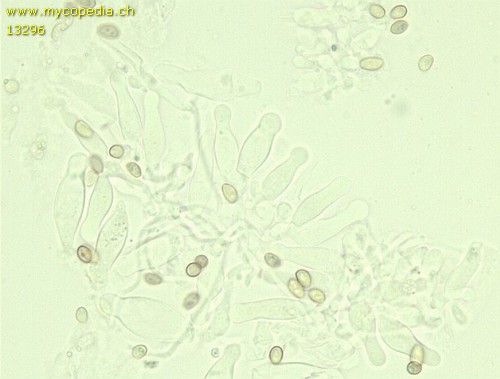 Hypholoma lateritium - Zystiden - KOH  - 