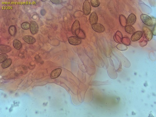 Hebeloma laterinum - Cheilozystiden - Kongorot  - 
