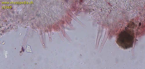 Rickenella fibula - Hymenialzystiden - 