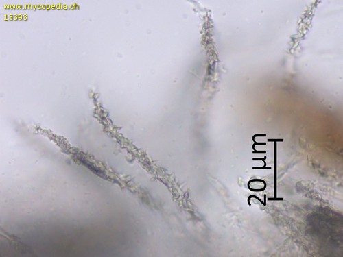 Flagelloscypha minutissima - Haare - 
