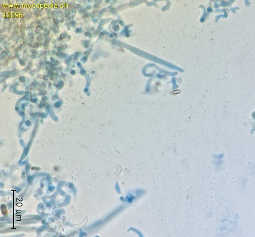 Rhizochaete radicata - Zystiden - 