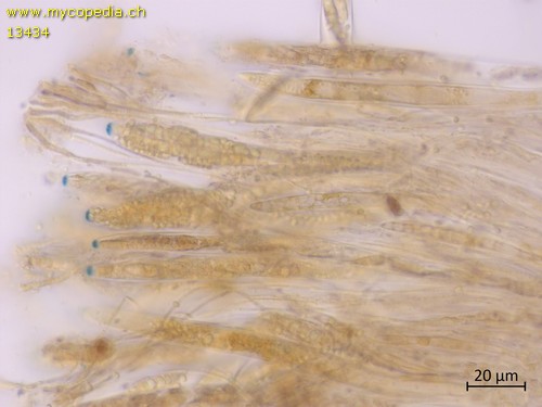 Ascocoryne cylichnium - Asci & Paraphysen - Melzers  - 