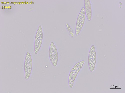 Ascocoryne cylichnium - Sporen - Wasser  - 