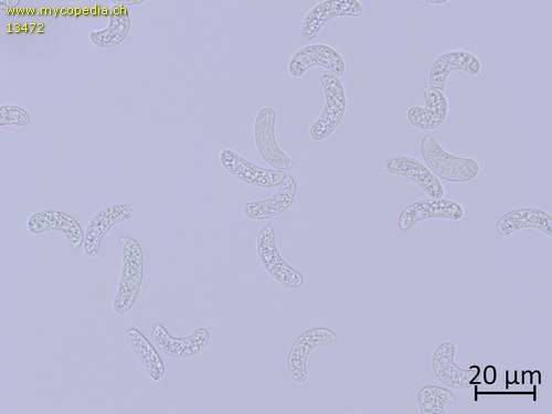 Corticium macrosporopsis - Sporen - Wasser  - 