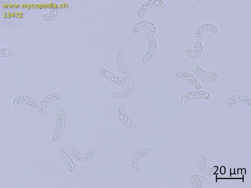 Corticium macrosporopsis - Sporen - Wasser  - 