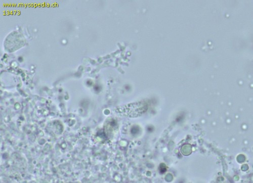 Corticium macrosporopsis - Dendrohyphiden - Wasser  - 