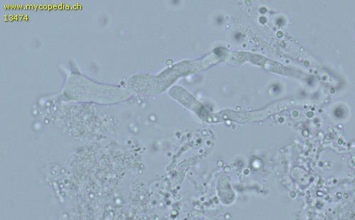 Corticium macrosporopsis - Basidien - Wasser  - 