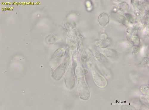 Lepiota subincarnata - Cheilozystiden - 