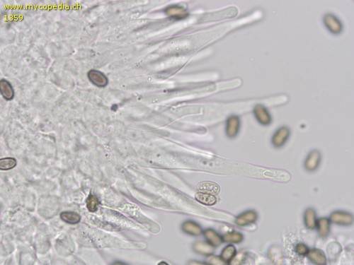Psathyrella multipedata - Cheilozystiden - 