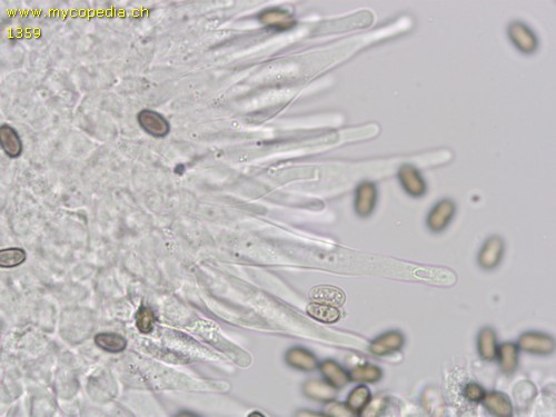 Britzelmayria multipedata - Cheilozystiden - 