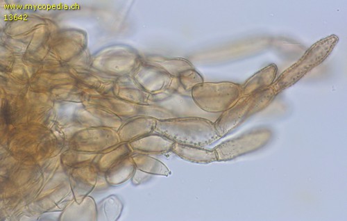 Coprinellus xanthothrix - Velum partiale - 