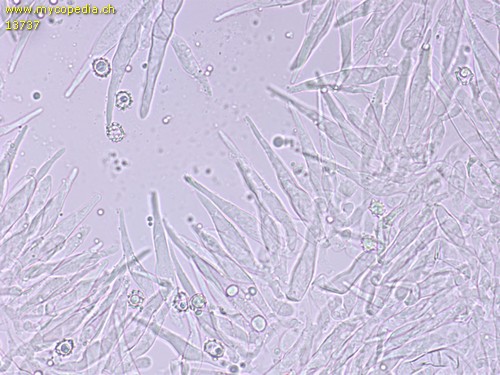 Russula violeipes - Cheilozystiden - 