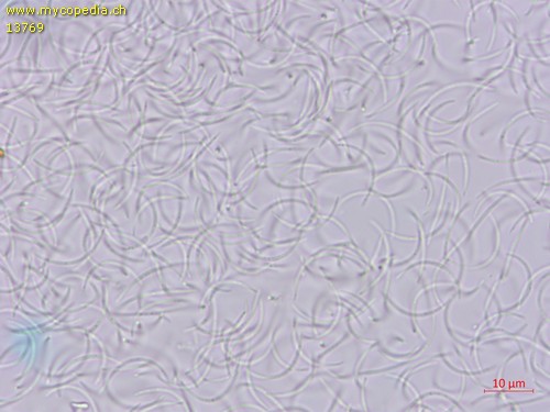 Cytospora 11048 - 