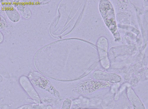 Pluteus romellii - Cheilozystiden - 